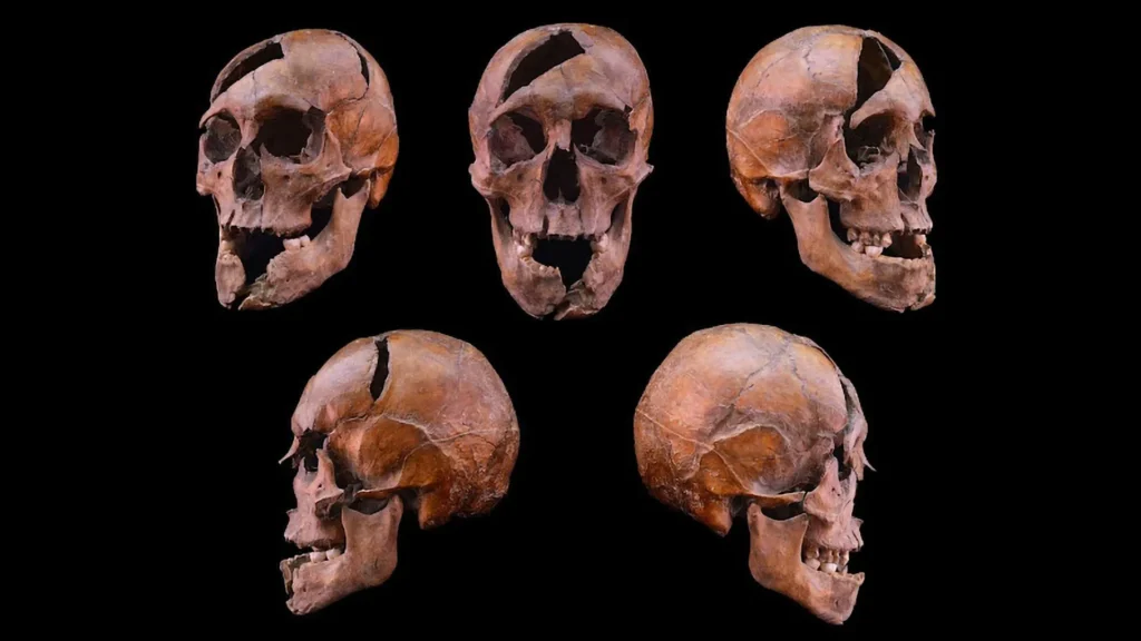 Science finally solves a 700-year-old royal murder