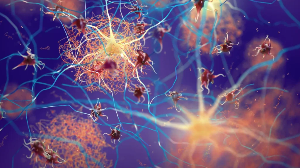 Scientists melt early protein clumps and shut down Alzheimer’s damage