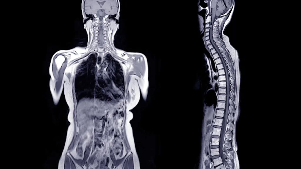 He ate a hamburger and died hours later. Doctors found a shocking cause