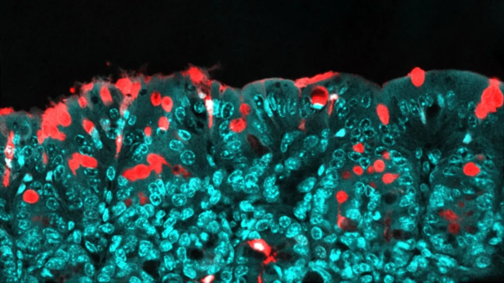 This common food ingredient may shape a child’s health for life This common food ingredient may shape a child’s health for life